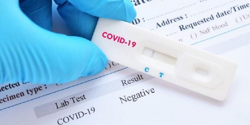  Test coronavirus. 