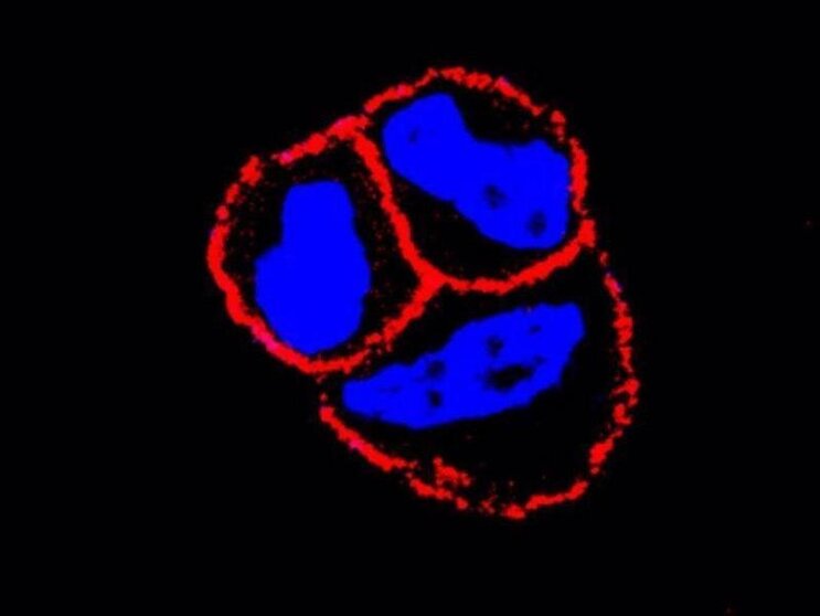  El CSIC evidencia que el uso combinado de un nuevo fármaco mejora la eficiencia de algunas terapias de cáncer de mama. // EP 