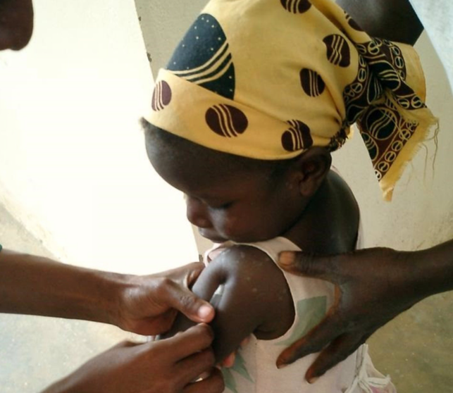 <p> Archivo - Una niña en un centro de salud de Mozambique recibe una inyección de la vacuna contra la malaria - ISGLOBAL - Archivo </p>