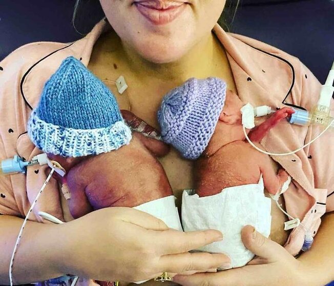 A mum has celebrated the arrival of the UK's most premature twins - who were given zero per cent chance of survival.See SWNS story SWSYtwins. A mum has celebrated the arrival of the UK's most premature twins - who were given zero per cent chance of survival. Little Harley and Harry Crane were conceived via IVF and were born at 22 weeks and five days - more than a week before the abortion limit.Babies born at 22 weeks are not classed as legally viable and medical intervention is sometimes not offered. But the tough siblings weren't going anywhere and have amazed doctors - who initially gave them a zero per cent chance of survival.
