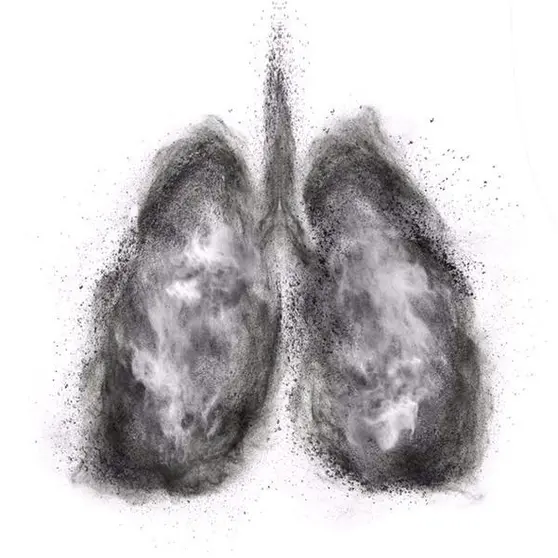 <p> Pulmones. - ARTJAZZ/ ISTOCK </p>