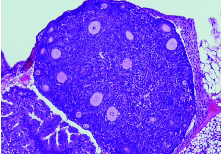  Reducción en el número de folículos ováricos (causante de la insuficiencia ovárica prematura) en los ratones con la variante humanizada en FOXL2. / Centro de Investigación del Cáncer (CSIC-USAL) 