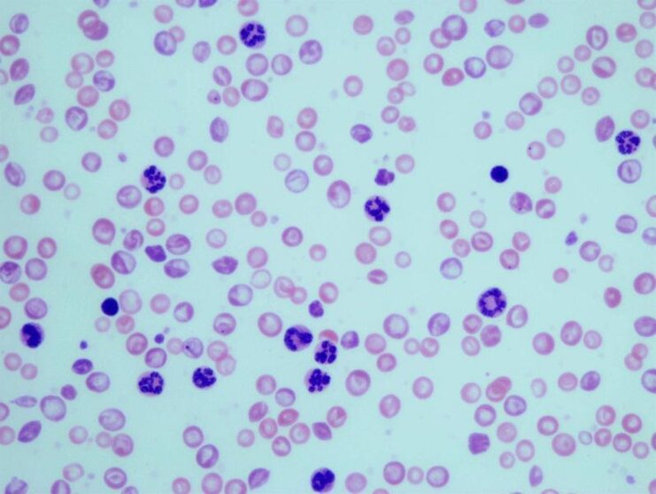  Granulocitos en muestras sanguíneas de ratones con leucemia mielogénica crónica 