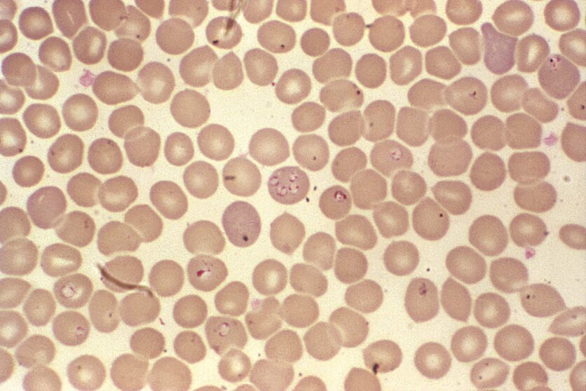  1979<br>Steven Glenn<br>Laboratory & Consultation Division<br><br>Other hemoprotozoan parasites such as these <i>Babesia sp.</i> organisms resemble <i>P. falciparum</i> organisms. <br><br>Though developmentally the <i>Babesia spp.</i> organisms resemble <i>Plasmodium falciparum</i>, these parasites present several distinguishing features: they vary more in shape and in size; and they do not produce pigment. 