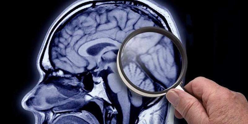  Foto de un cerebro. Vía: twitter 