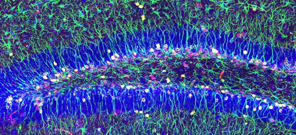  Imagen de microscopía confocal mostrando las células madre neurales del hipocampo 