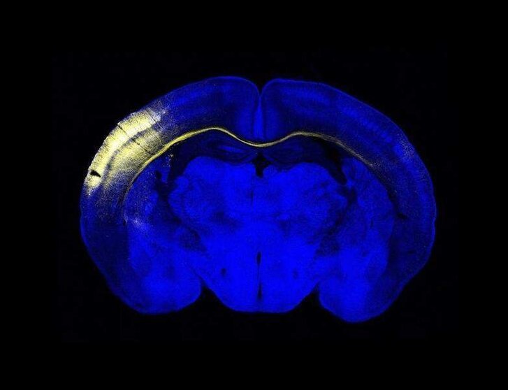  Nueronas en el cerebro 