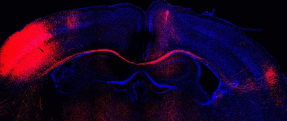  Imagen de microscopía de un corte cerebral con las conexiones formadas por neuronas (rojo). - LORENA BRAGG-GONZALO, CNB-CSIC 