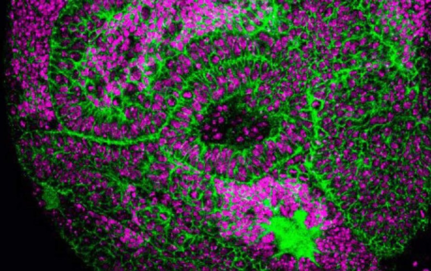  Imagen del estudio sobre los genes germinales y su papel en el desarrollo de tumores cerebrales en la mosca Drosophila - IRB BARCELONA 