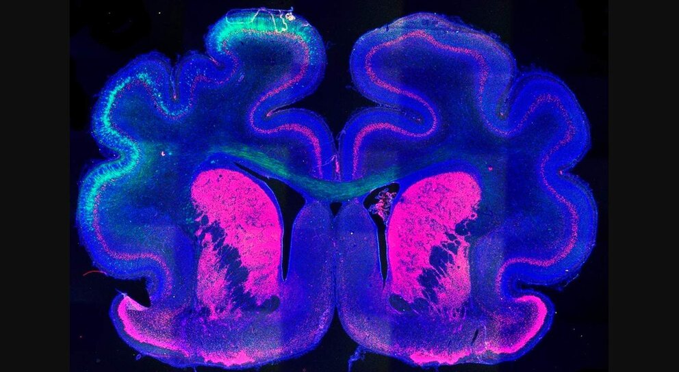  Imagen Del Cerebro De Un Hurón Que Muestra El Patrón De Plegamiento Alterado (Izquierda) Por La Proteína Cux2. - IN (CSIC-UMH). 