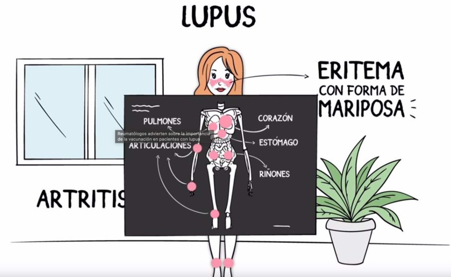  Reumatólogos advierten sobre la importancia de la vacunación en pacientes con lupus - FEDERACIÓN ESPAÑOLA DE LUPUS 