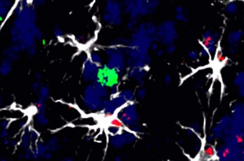  Células en torno a una metástasis cerebral en modelo animal - CNIO 